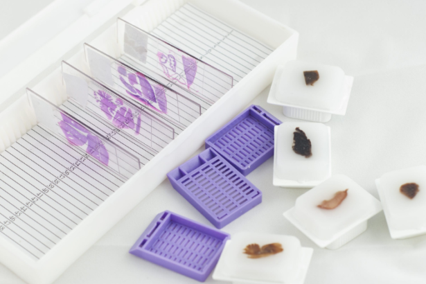 FFPE Human Tissue Samples: 3 Cutting-Edge Research Applications